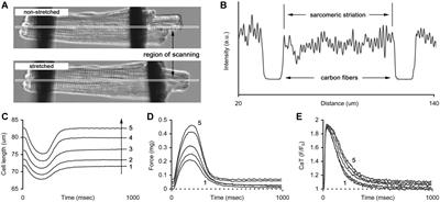 Length-Dependent Activation of Contractility and Ca-Transient Kinetics in Auxotonically Contracting Isolated Rat Ventricular Cardiomyocytes